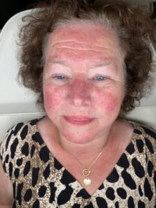wenkbrauw tatoeage voor 3